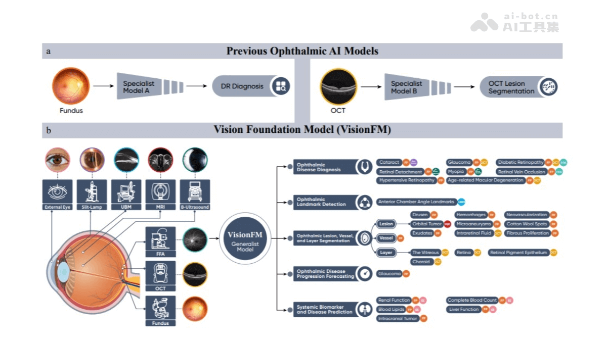 VisionFM  通用眼科AI大模型，具备少样本多种疾病诊断能力